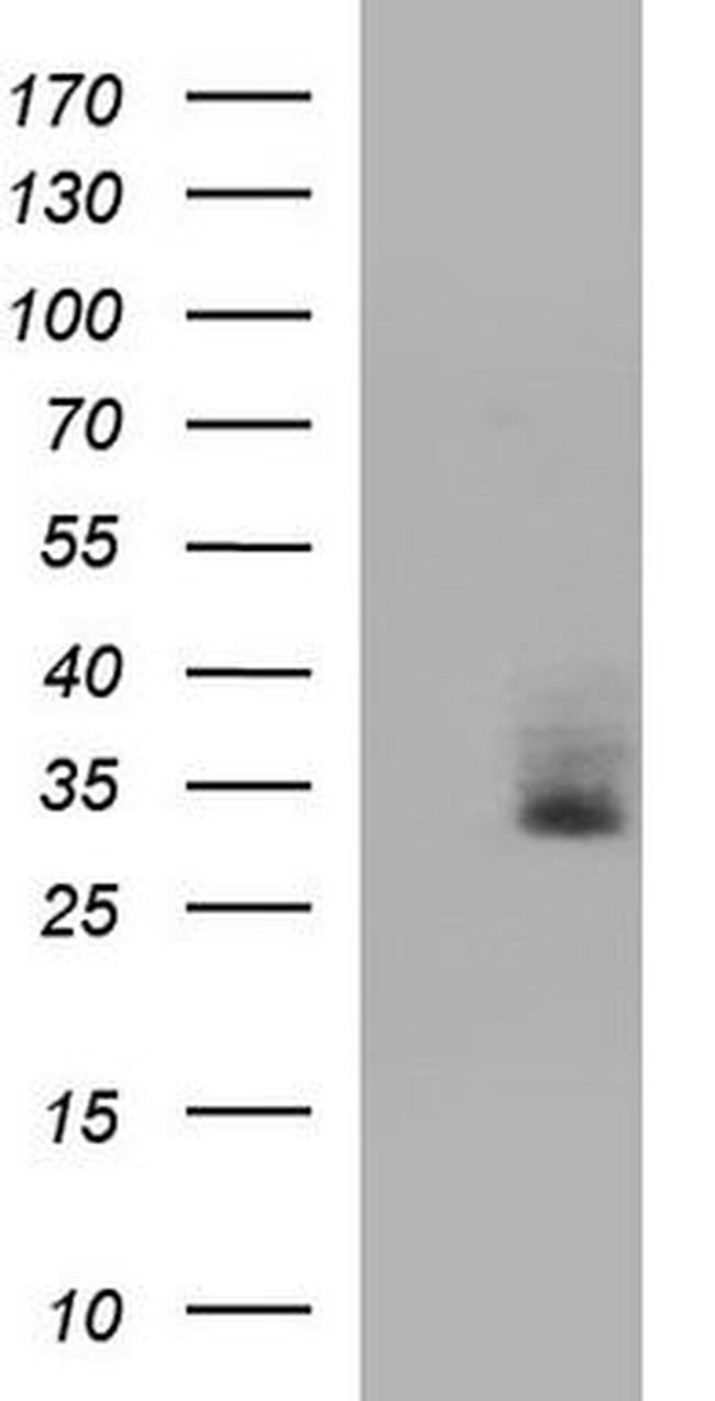 STOML3 Antibody in Western Blot (WB)