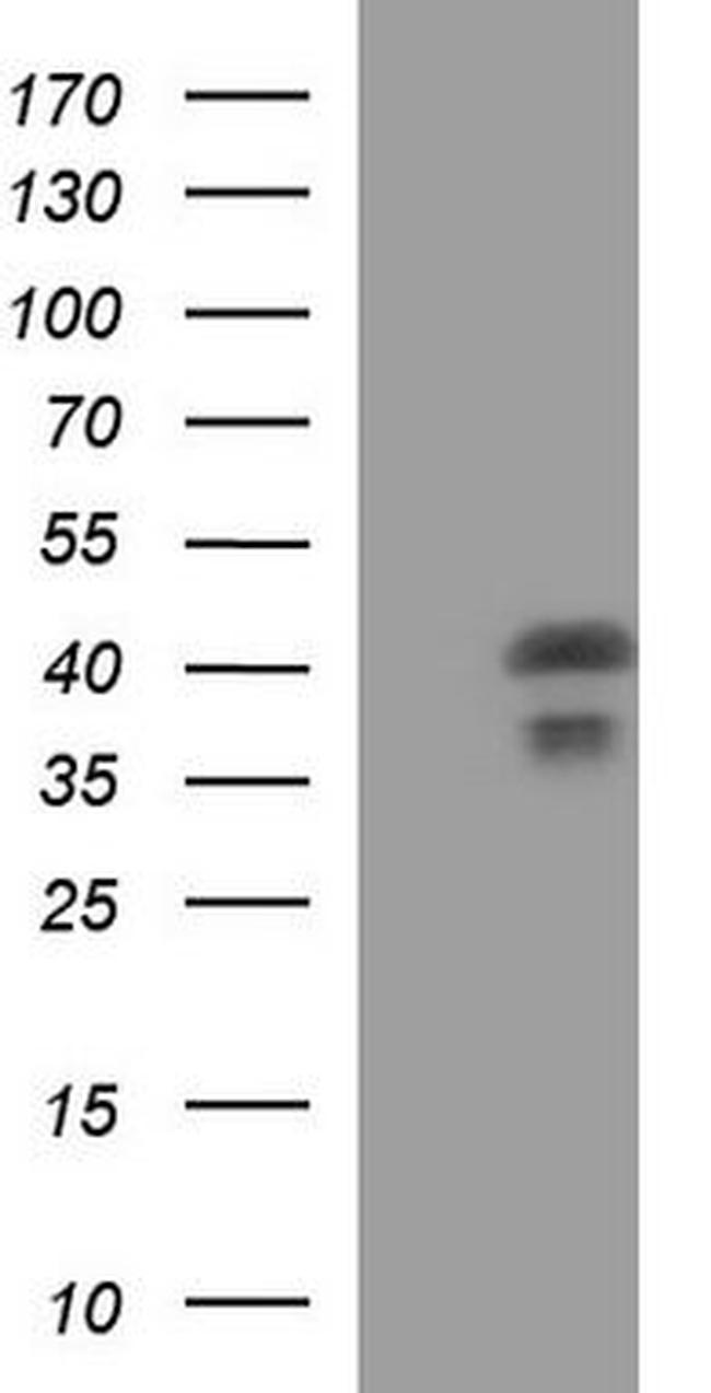KLK8 Antibody in Western Blot (WB)