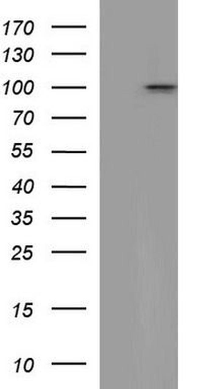 VCAM1 Antibody in Western Blot (WB)