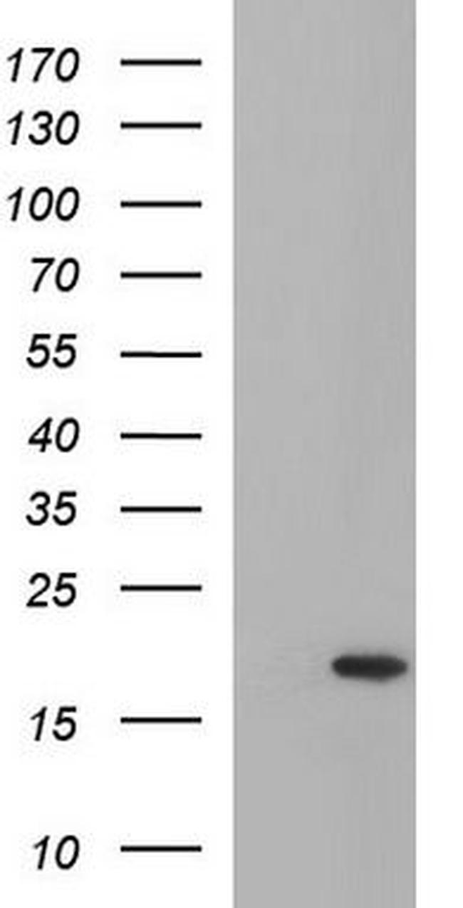 p18 INK4c Antibody in Western Blot (WB)