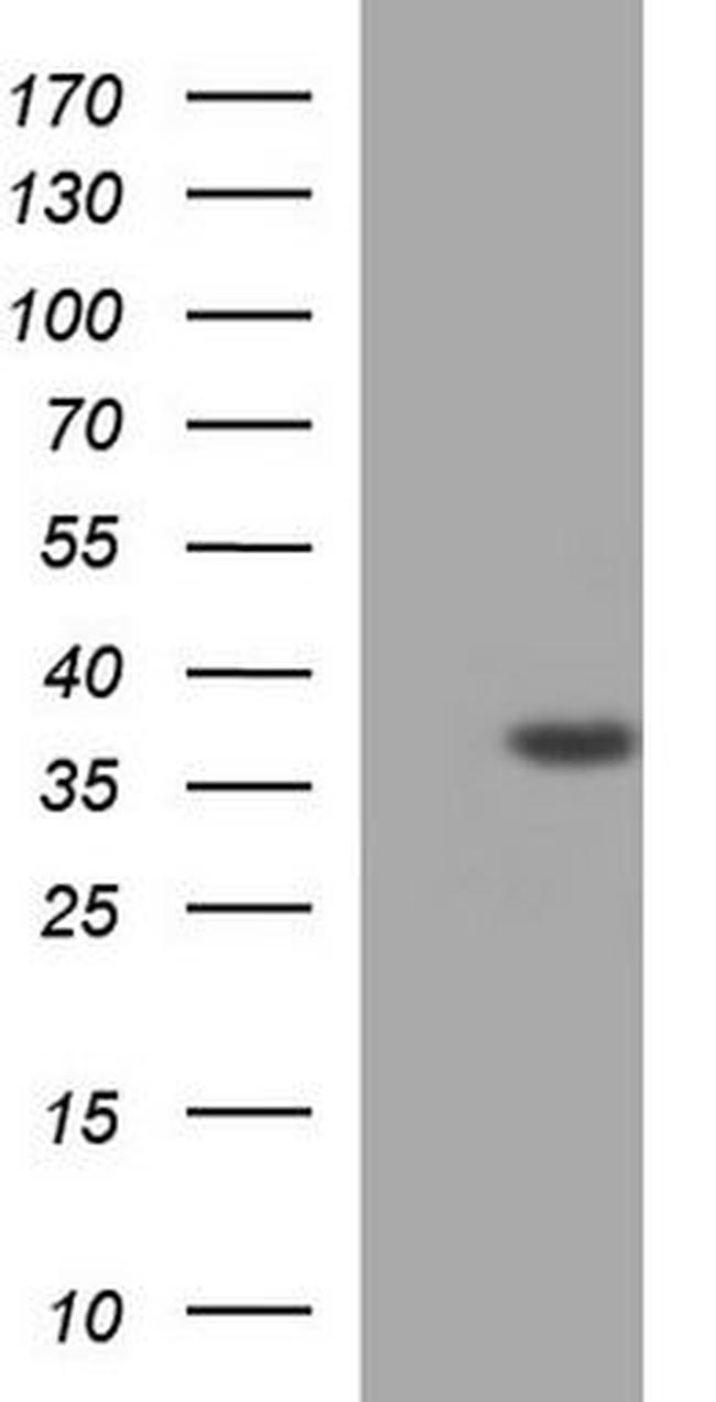 Caspase 7 Antibody in Western Blot (WB)