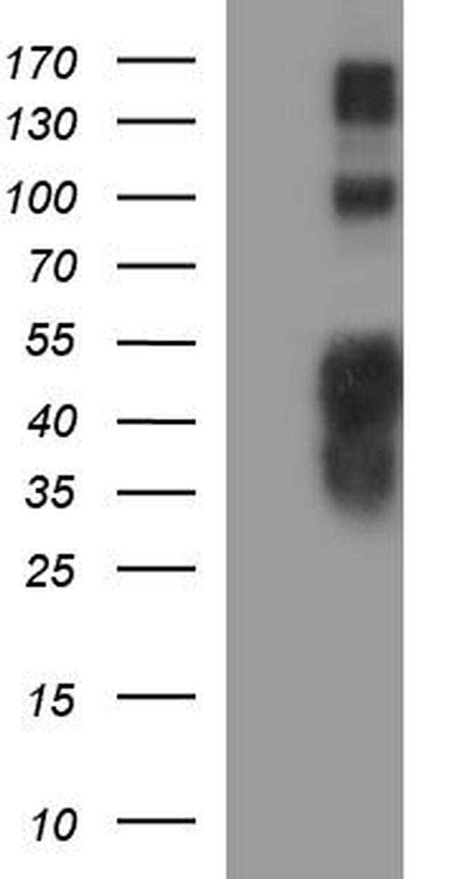 TNIP2 Antibody in Western Blot (WB)