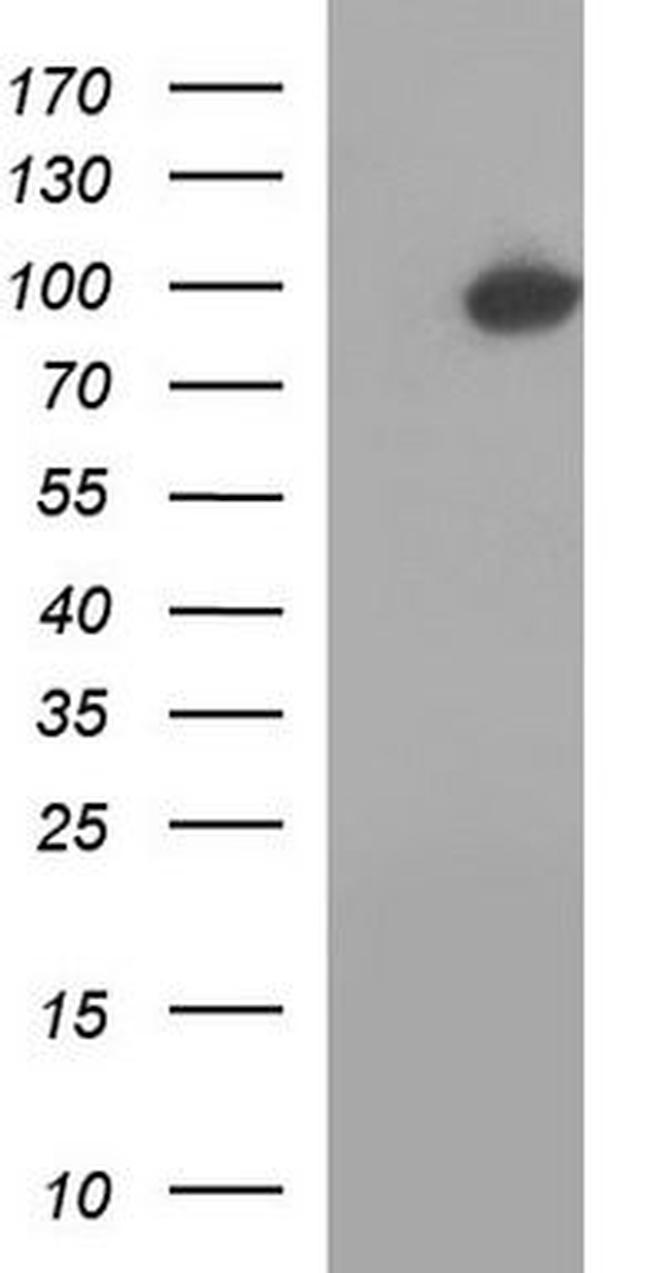 NAD Synthetase Antibody in Western Blot (WB)