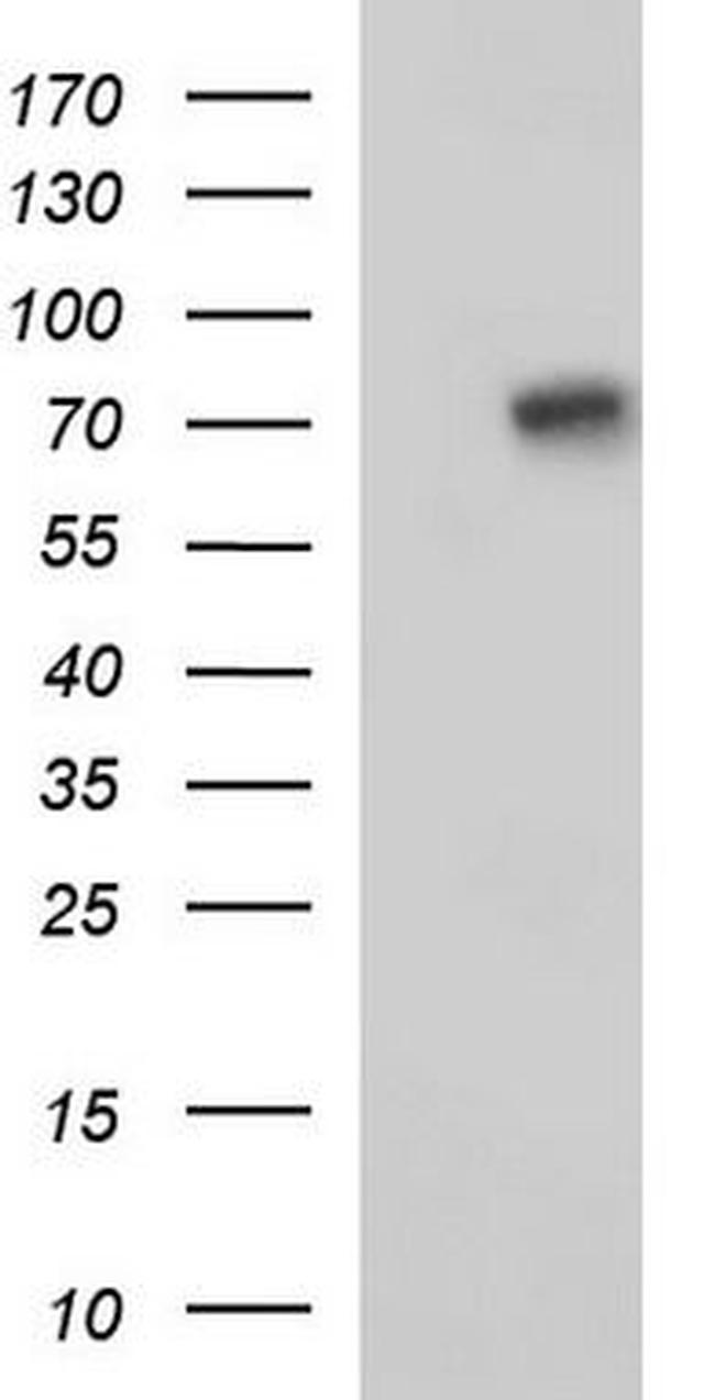 EFHC1 Antibody in Western Blot (WB)