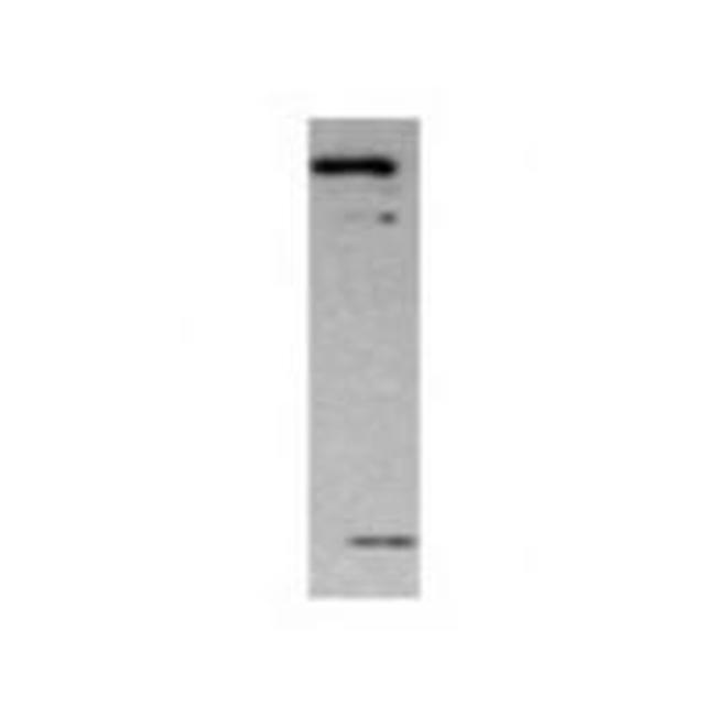 MMP17 Antibody in Western Blot (WB)