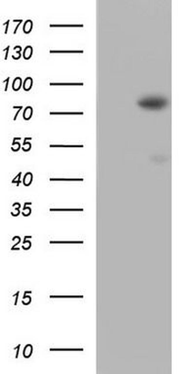 ANKRD6 Antibody in Western Blot (WB)