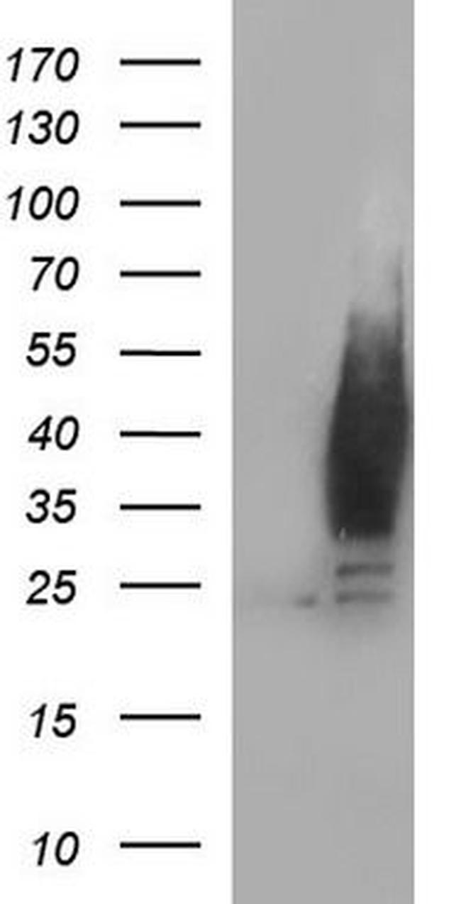 LYPD3 Antibody in Western Blot (WB)