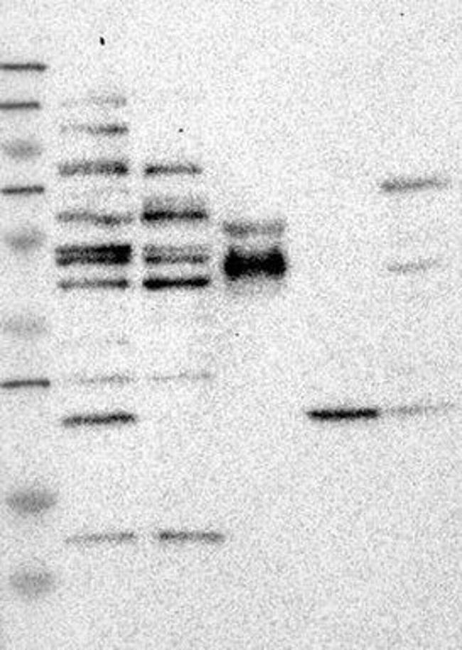 STAU2 Antibody in Western Blot (WB)