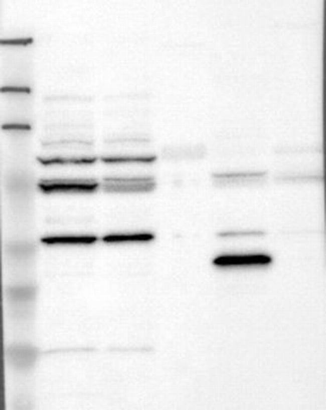 Opsin 3 Antibody in Western Blot (WB)