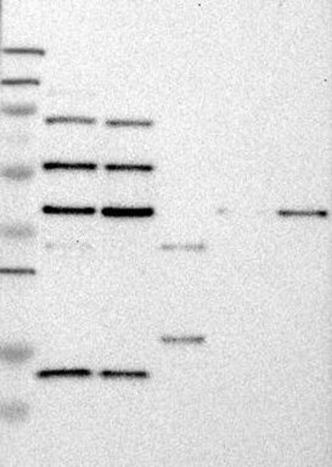 ANKRD11 Antibody in Western Blot (WB)
