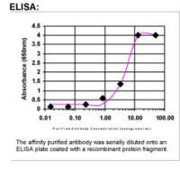BRCA1 Antibody in ELISA (ELISA)