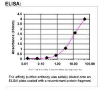 BRCA1 Antibody in ELISA (ELISA)