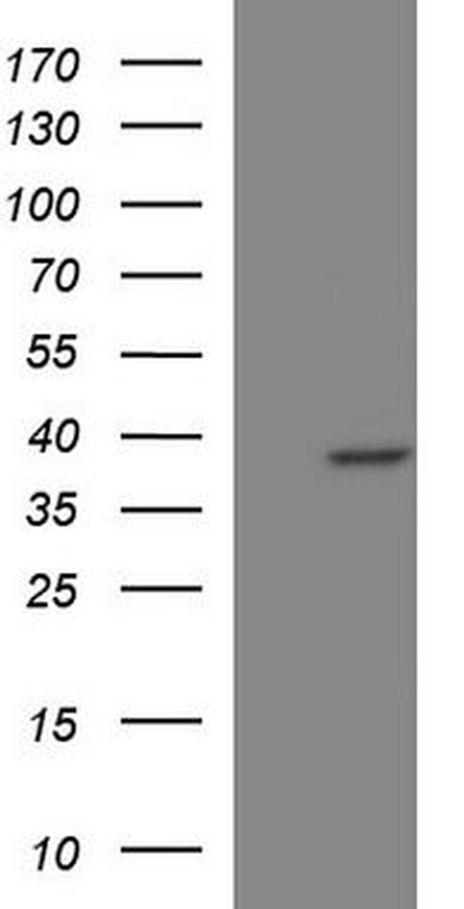 PHYH Antibody in Western Blot (WB)