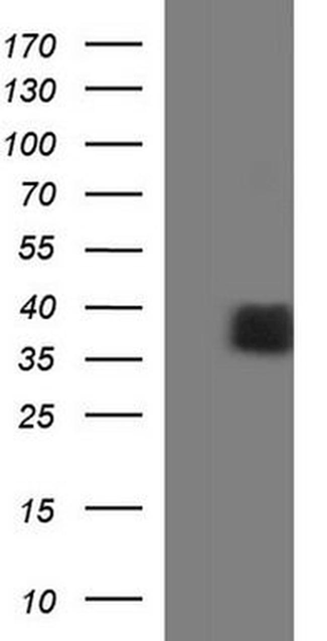 OLIG2 Antibody in Western Blot (WB)