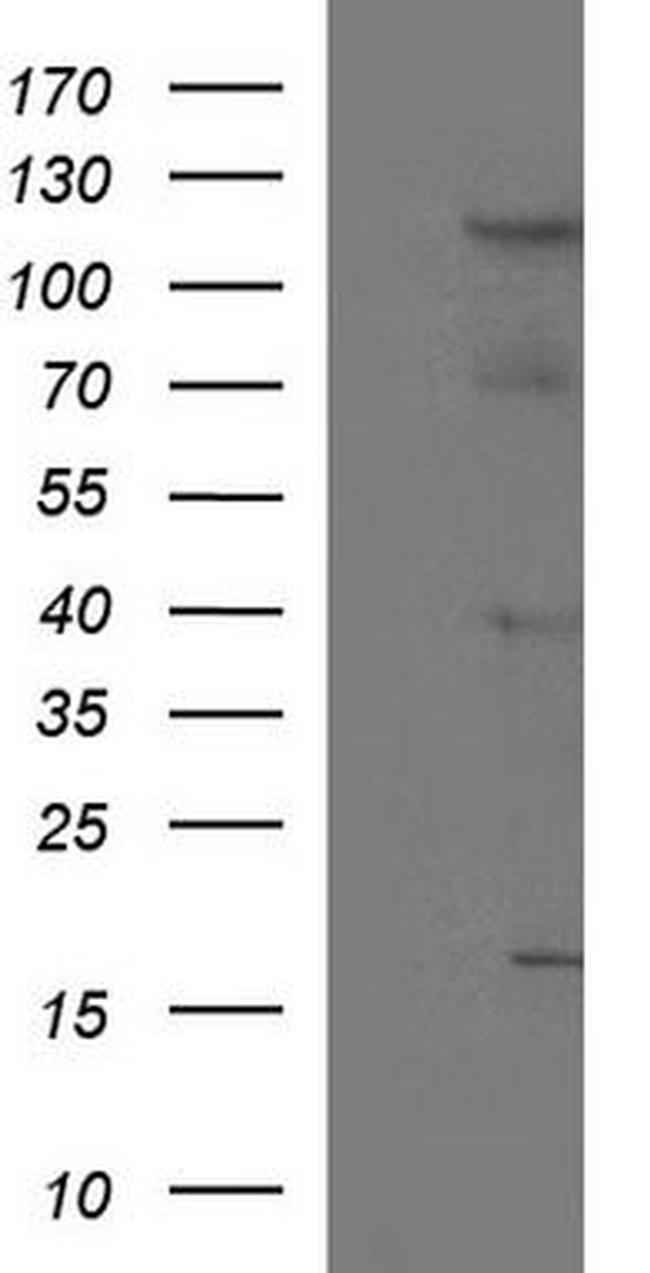 TIE1 Antibody in Western Blot (WB)