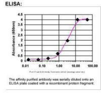 EPRS Antibody in ELISA (ELISA)