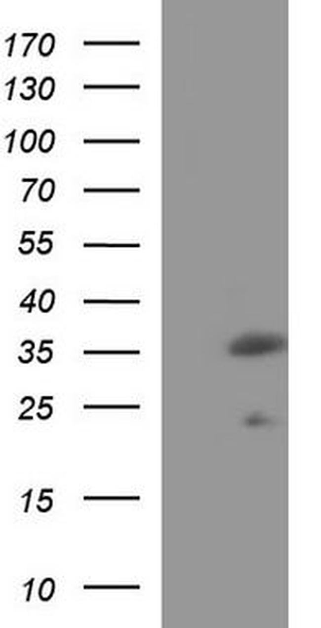 VEGFB Antibody in Western Blot (WB)