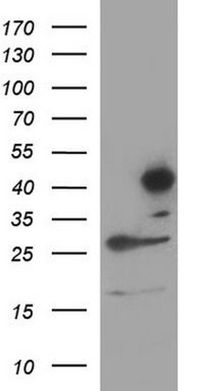 SERPINB4 Antibody in Western Blot (WB)
