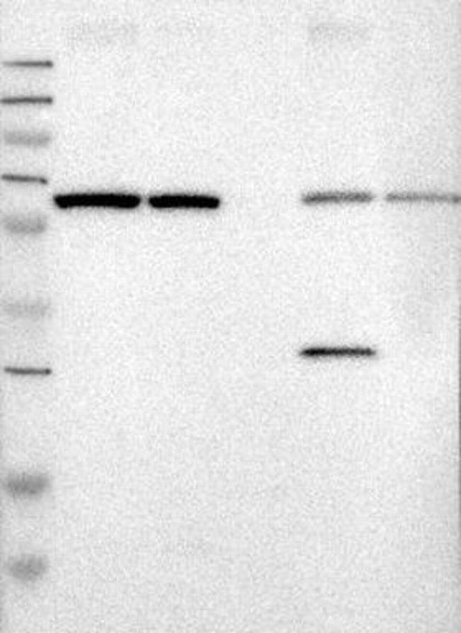 Ribophorin II Antibody in Western Blot (WB)