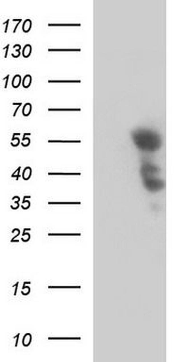 PTPN1 Antibody in Western Blot (WB)