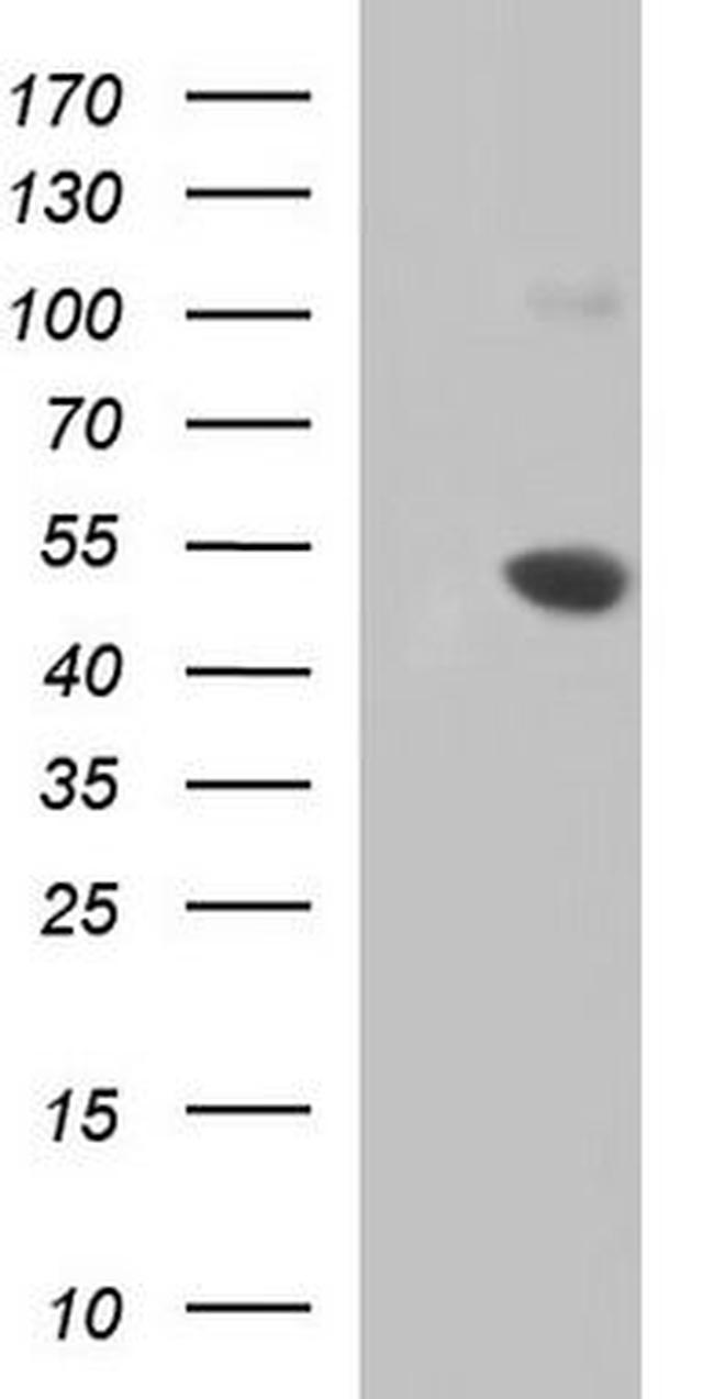 MASPIN Antibody in Western Blot (WB)