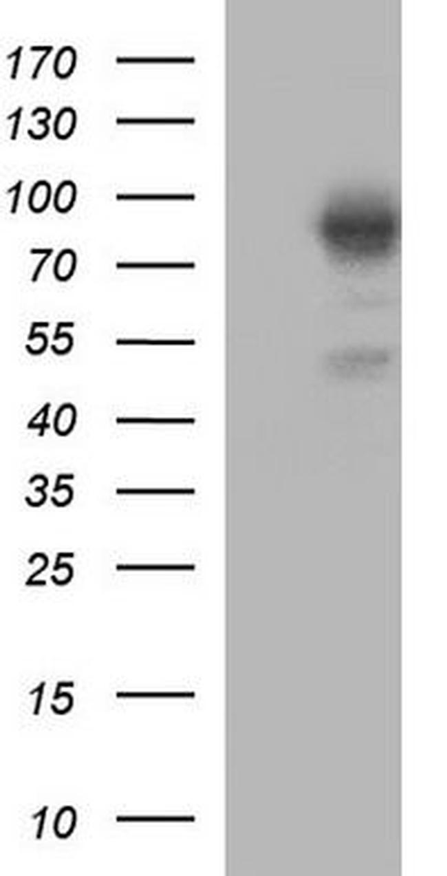 NBS1 Antibody in Western Blot (WB)