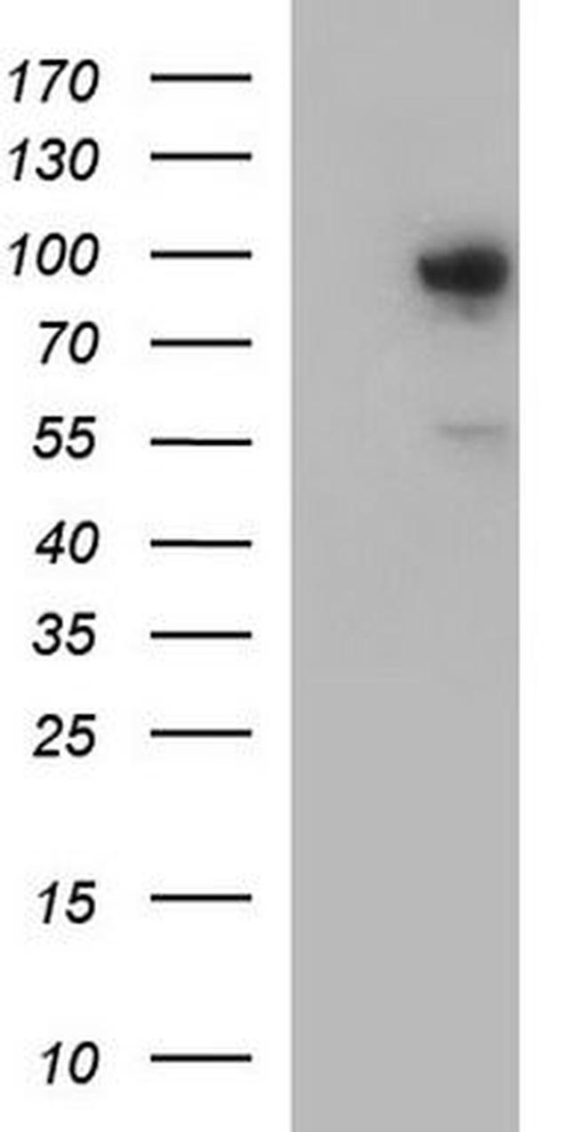 FES Antibody in Western Blot (WB)