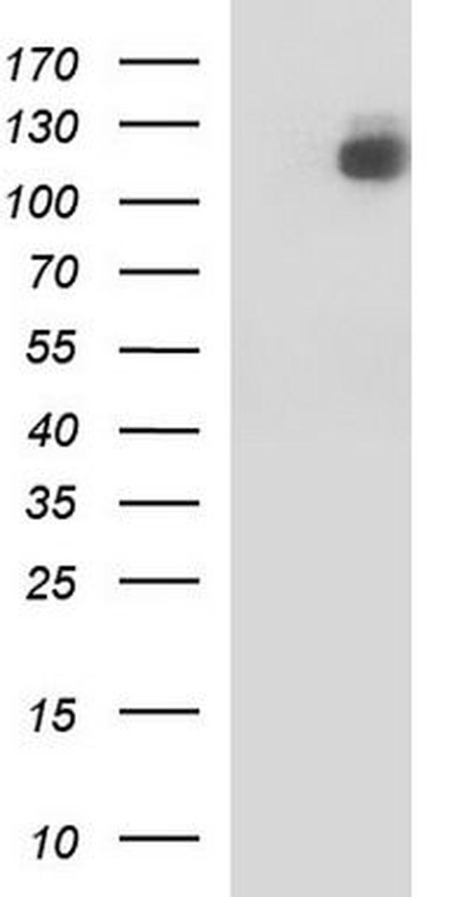 Aminopeptidase A/APA Antibody in Western Blot (WB)