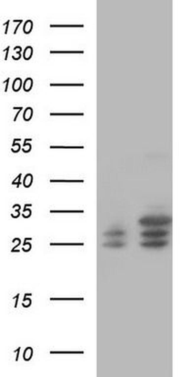CLNS1A Antibody in Western Blot (WB)