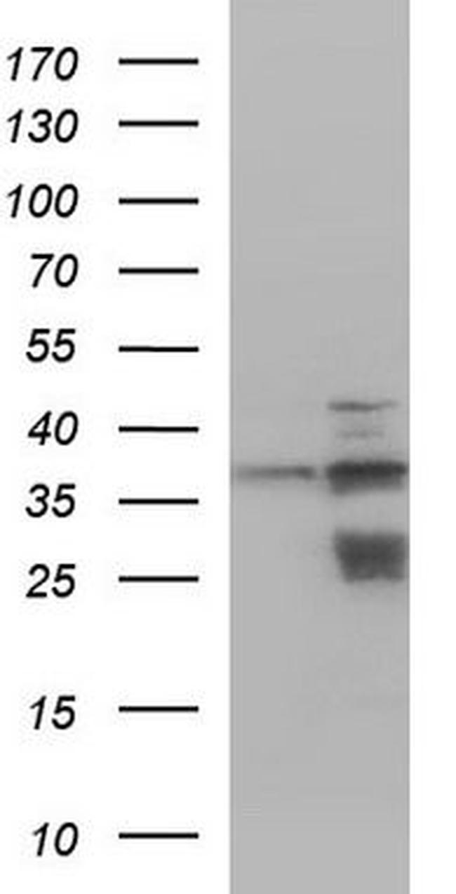 Cathepsin V Antibody in Western Blot (WB)