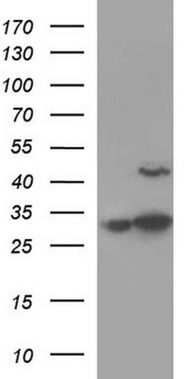AAMP Antibody in Western Blot (WB)