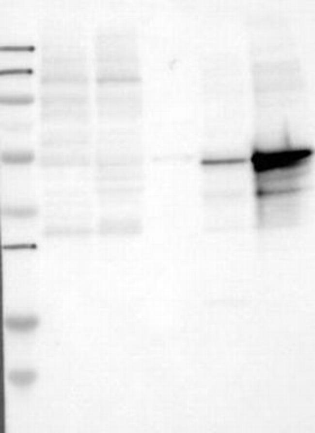 LSP1 Antibody in Western Blot (WB)