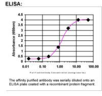 Growth hormone receptor Antibody in ELISA (ELISA)