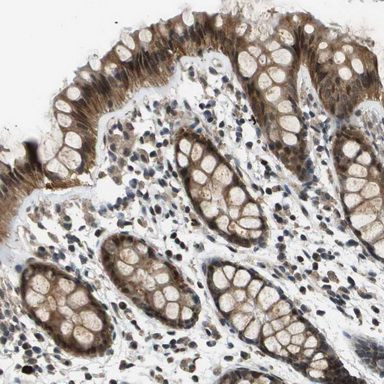 FANCC Antibody in Immunohistochemistry (IHC)