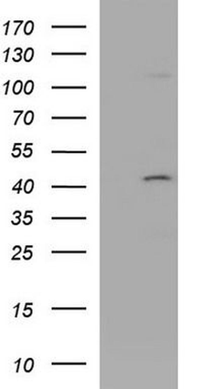 Cytohesin 2 Antibody in Western Blot (WB)