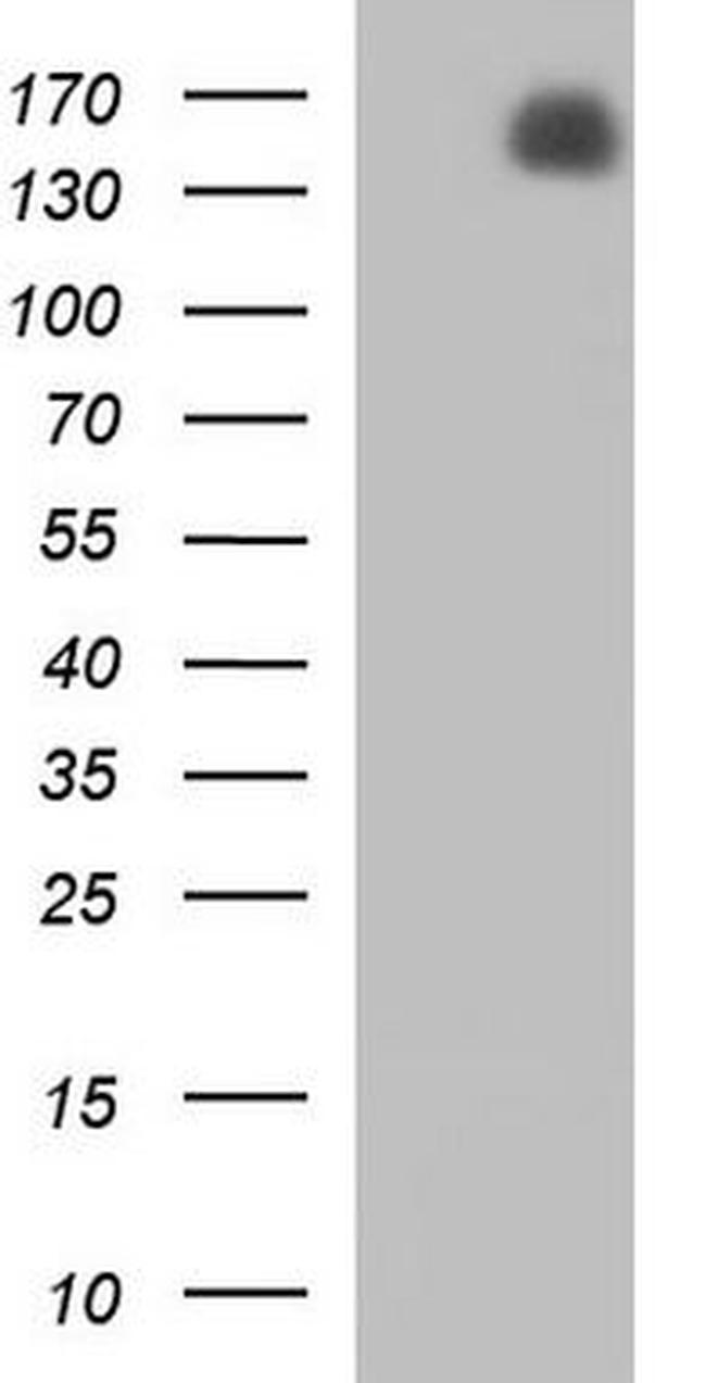 PHLPP2 Antibody in Western Blot (WB)