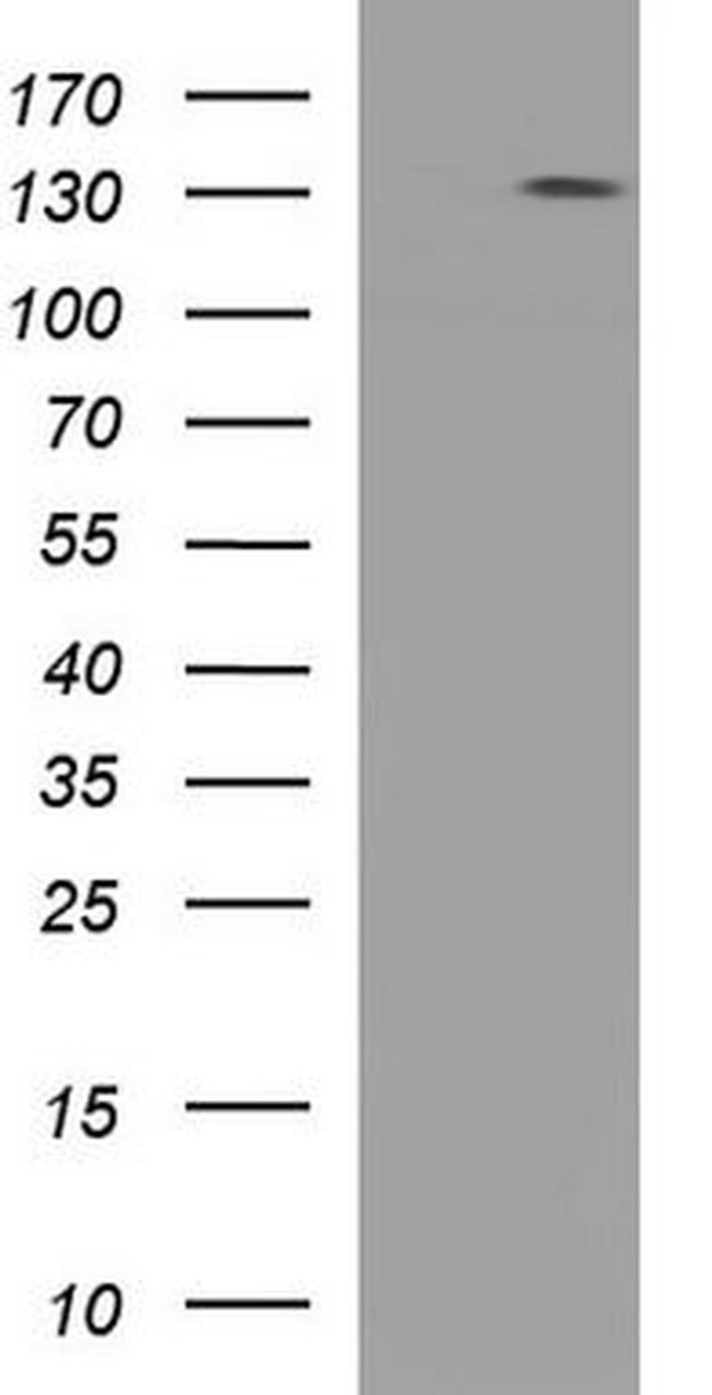 ITIH5L Antibody in Western Blot (WB)