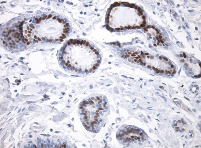 ER Antibody in Immunohistochemistry (Paraffin) (IHC (P))