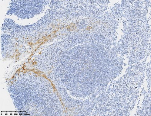 P16 (CDKN2A) Antibody in Immunohistochemistry (Paraffin) (IHC (P))