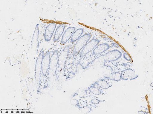 Desmin (DES) Antibody in Immunohistochemistry (Paraffin) (IHC (P))