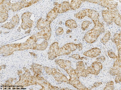 GS (GLUL) Antibody in Immunohistochemistry (Paraffin) (IHC (P))