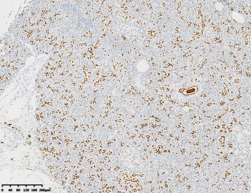 HNF1-Beta (HNF1B) Antibody in Immunohistochemistry (Paraffin) (IHC (P))