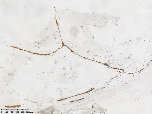 E-Cadherin (CDH1) Antibody in Immunohistochemistry (Paraffin) (IHC (P))