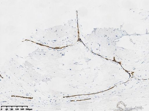 E-Cadherin (CDH1) Antibody in Immunohistochemistry (Paraffin) (IHC (P))
