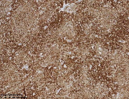 BCL2 Antibody in Immunohistochemistry (Paraffin) (IHC (P))