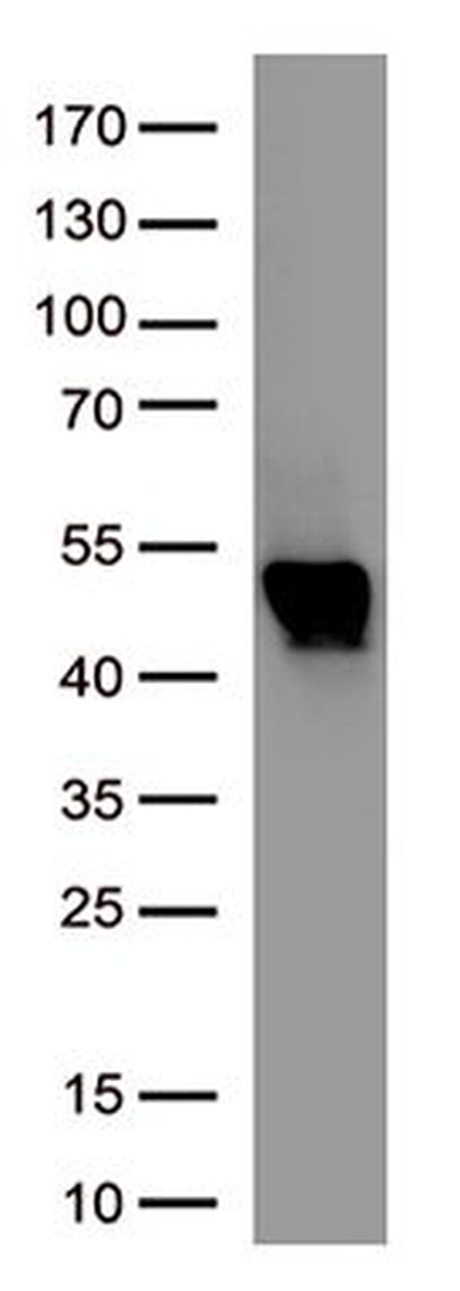 SARS-CoV-2 N Protein Antibody in Western Blot (WB)