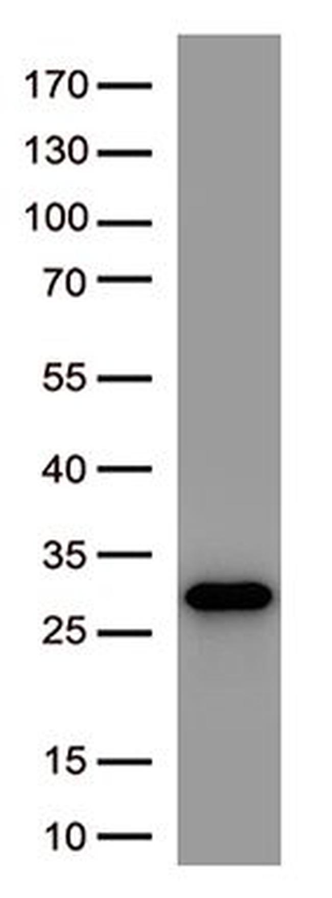 SARS-CoV-2 Spike Protein Antibody in Western Blot (WB)