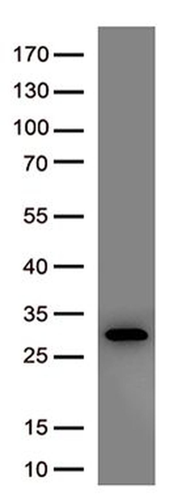 SARS-CoV-2 Spike Protein Antibody in Western Blot (WB)