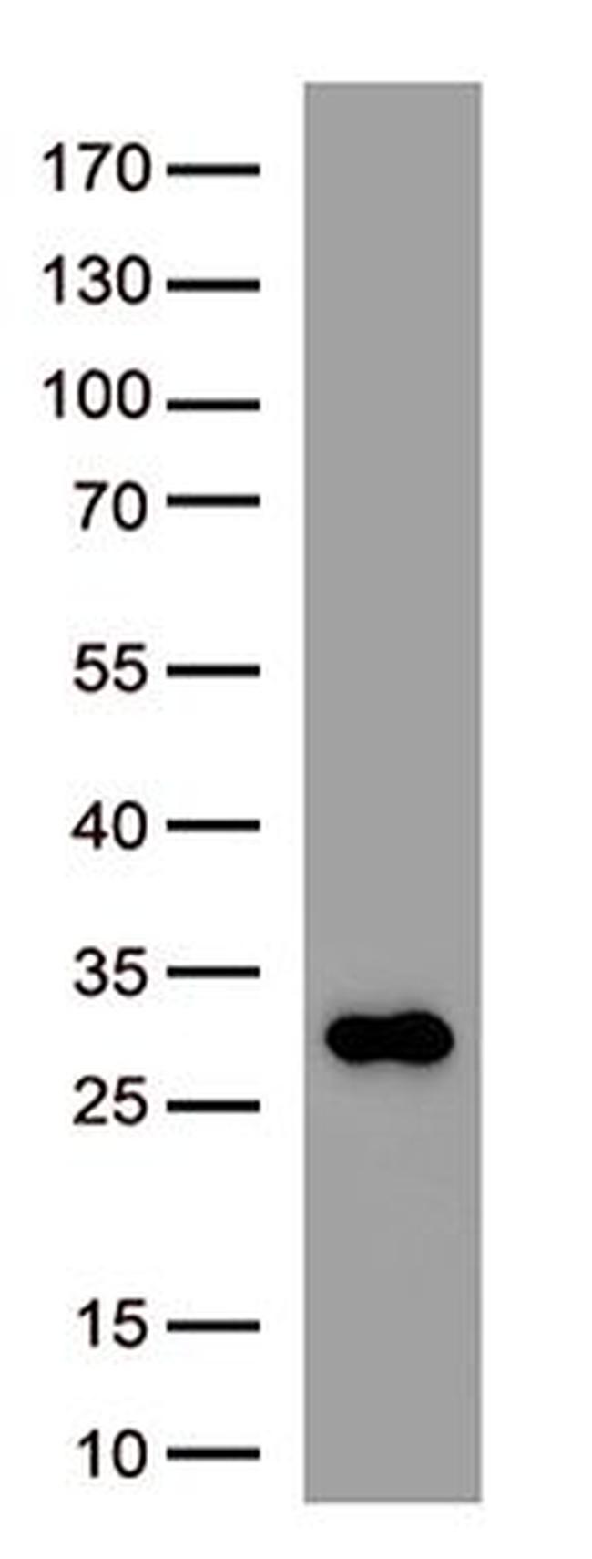 SARS-CoV-2 Spike Protein Antibody in Western Blot (WB)