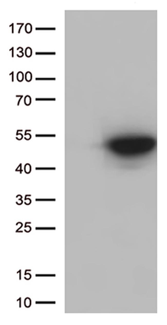 CDK15 Antibody in Western Blot (WB)